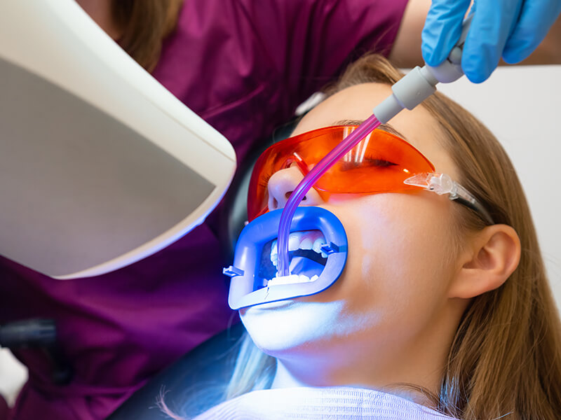 Clareamento dental