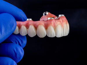 prótese overdenture