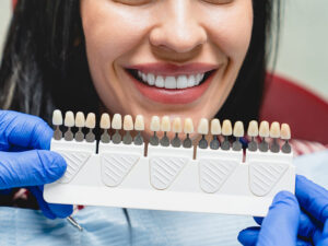Lentes de contato dental