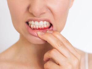 periodontia