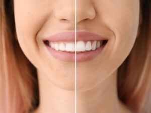 periodontia