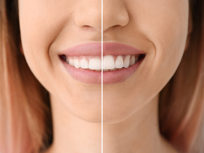 periodontia